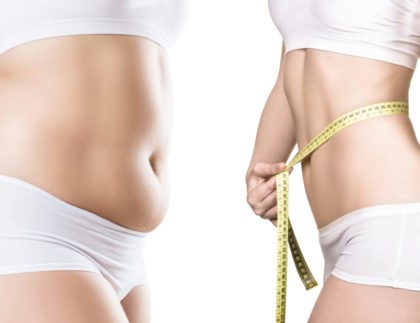 Liposuction in Bangalore